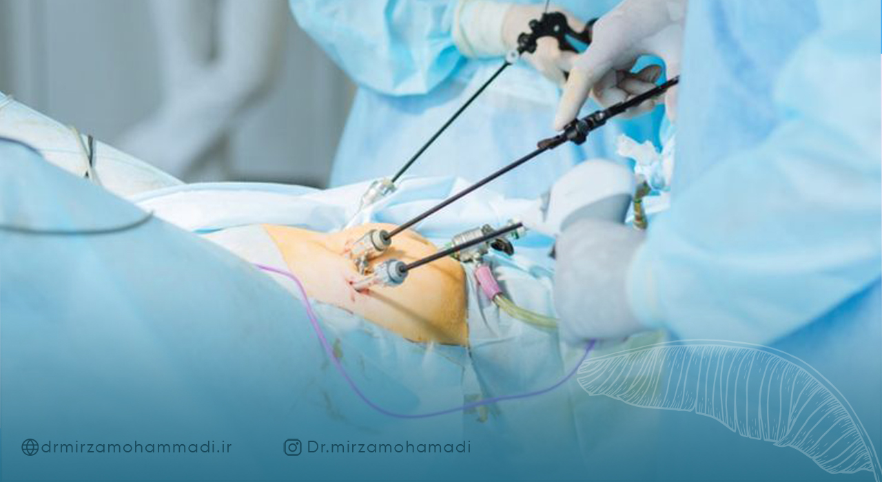 مزایای لاپاراسکوپی از طریق واژن