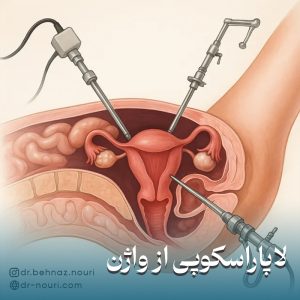 لاپاراسکوپی از طریق واژن