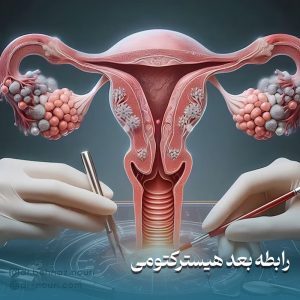 رابطه جنسی بعد از هیسترکتومی