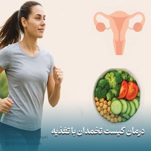 برای درمان کیست تخمدان چی بخوریم؟